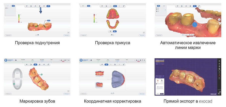 Интраоральный сканер Аоралскан Л (люкс, полное ПО) - Фото 10